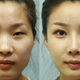 Image for article titled How South Korean Plastic Surgeons Make Passport Photos Worthless